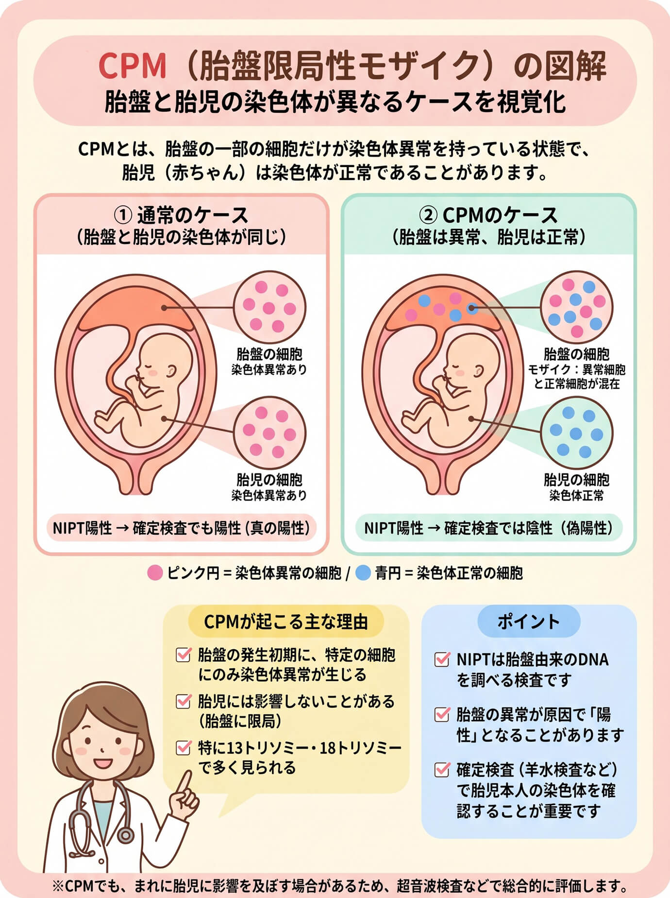 CPM(胎盤限局性モザイク)の図解